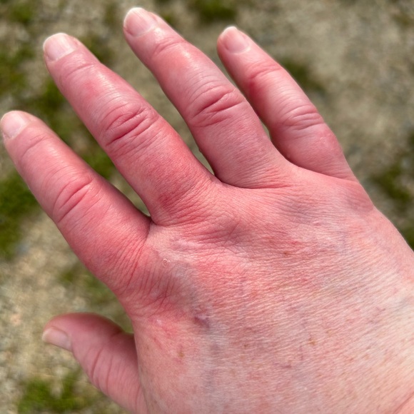 Your purchases help me while i try to get disability for a rare brain disease - Picture 9 of 10